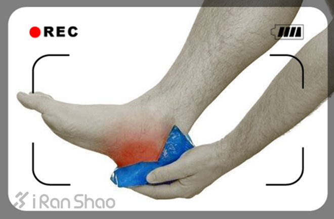 你的足底痛么？跑步足底痛防治方法