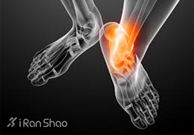 你的足底痛么？跑步足底痛防治方法