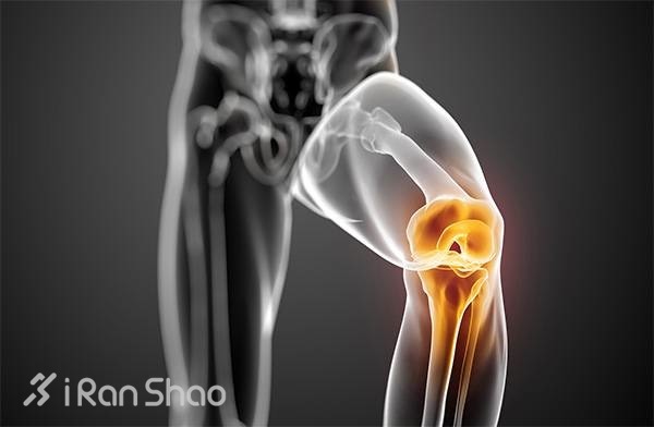 跑步真的伤膝盖么？（中）