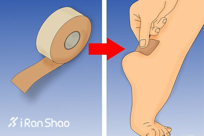 我贴我贴我贴贴贴，运动胶贴综览