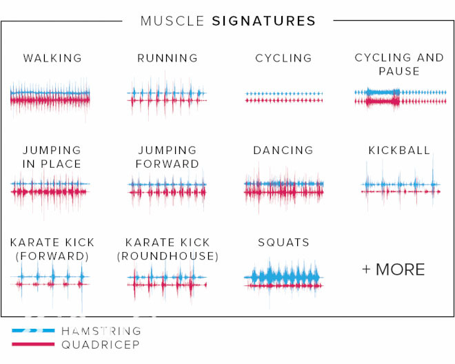 自带治愈光环—LEO：能预知伤病的智能腿套