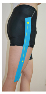 肌内贴不再神秘，贴出你的运动健康（下）