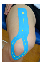 肌内贴不再神秘，贴出你的运动健康（下）