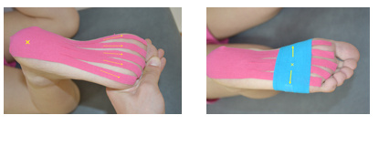 肌内贴不再神秘，贴出你的运动健康（下）