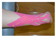 肌内贴不再神秘，贴出你的运动健康（下）