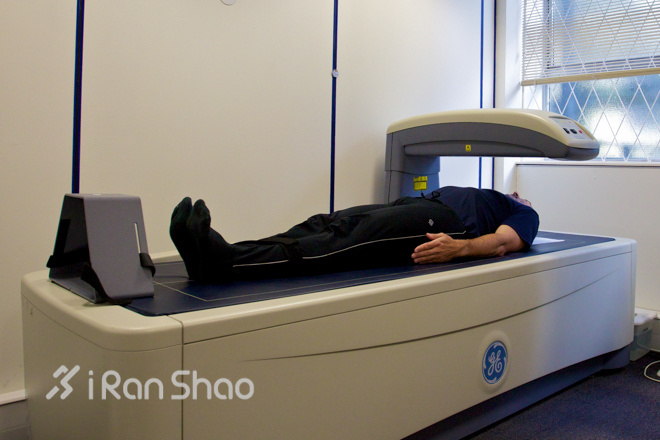 肥胖的标准—谁是脂肪重度携带者？