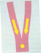 肌内贴不再神秘，贴出你的运动健康（上）