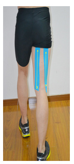 肌内贴不再神秘，贴出你的运动健康（下）