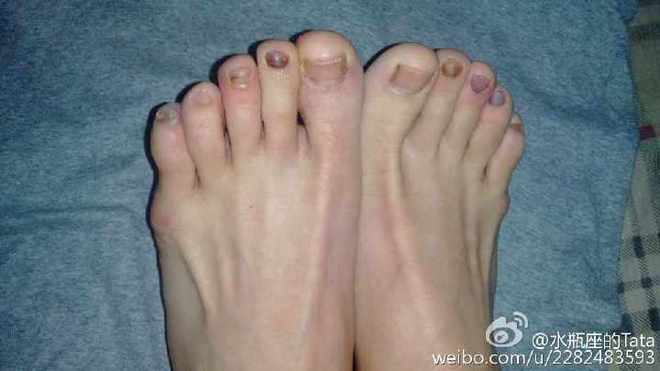 Tata's越野初体验——记我的2015TNF北京国际越野挑战赛