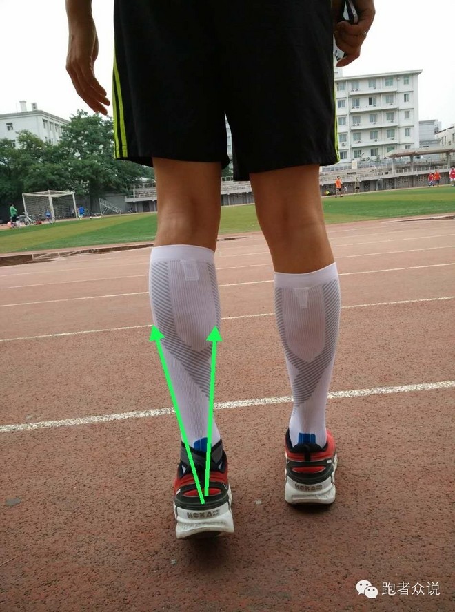 跑步踝关节内外翻杂谈