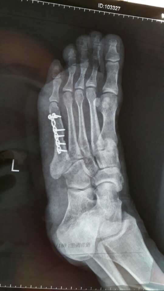 北马不缺席 | 钢铁女侠要跑2015北马！！！