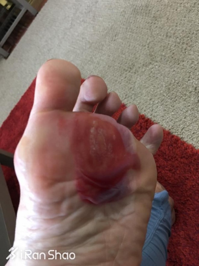 人物 | 留美博士刘子杨：你不知道的华人马拉松冠军