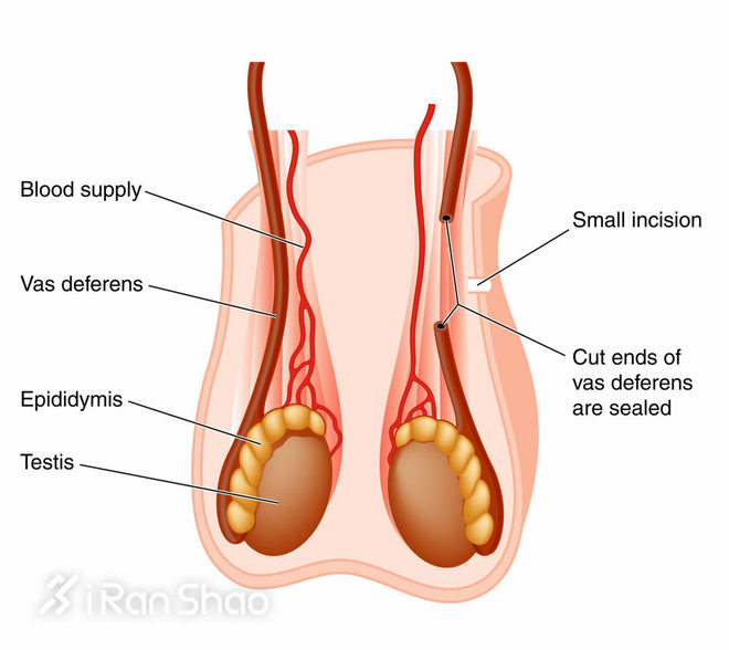 特别企划 | 关爱男性健康 我们来扯扯蛋那些事儿（内含视频彩蛋）