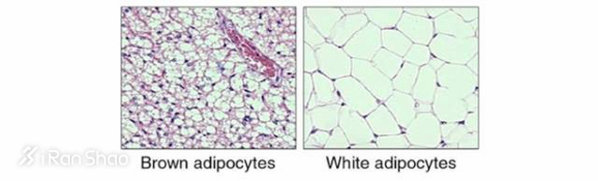 黑科技 | 这款背心让你在家“葛优躺“也能轻松瘦身