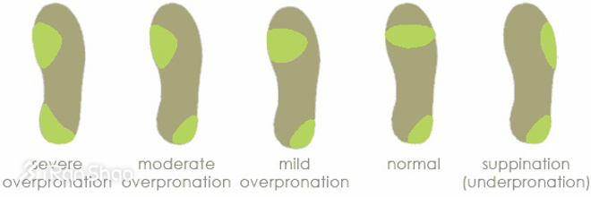 科普 | 内外翻，你是不是一直搞反了？