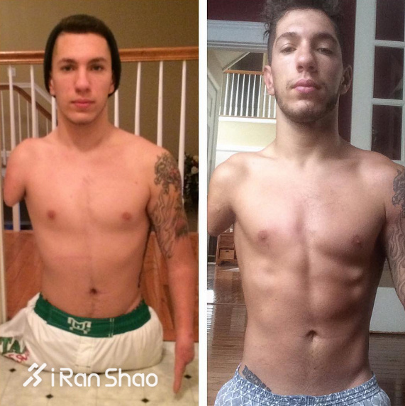 人物 | 他四肢不全却有六块腹肌 那你呢？