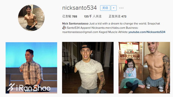 人物 | 他四肢不全却有六块腹肌 那你呢？