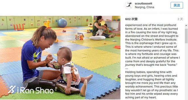 人物 | 就算她失去了一条腿 也不能阻止她爱跑步