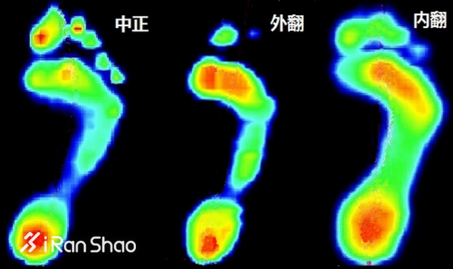 科普 | 内外翻，你是不是一直搞反了？