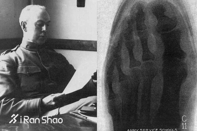 TopX | 关于跑鞋，值得一读的13本书