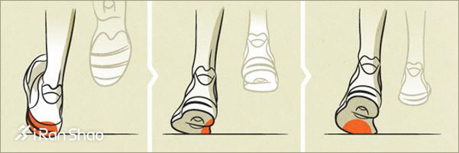 科普 | 内外翻，你是不是一直搞反了？