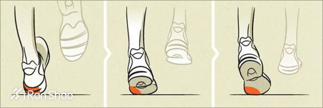 科普 | 内外翻，你是不是一直搞反了？