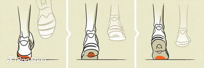科普 | 内外翻，你是不是一直搞反了？