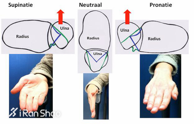 科普 | 内外翻，你是不是一直搞反了？