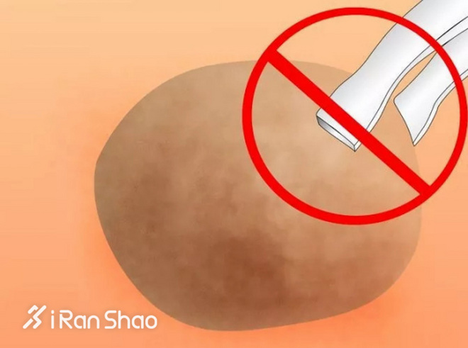 科普 | 水泡不是病，跑起来要人命！水泡原因全解析并附带预防解决办法