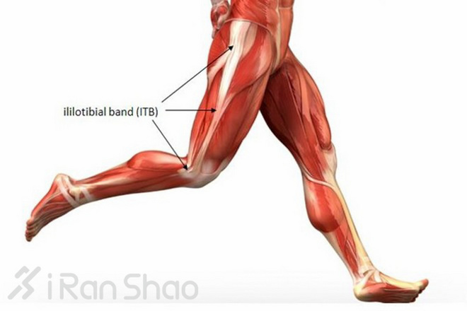 隐藏在膝盖周围的杀手—髂胫束综合征（ITBS）介绍与防治