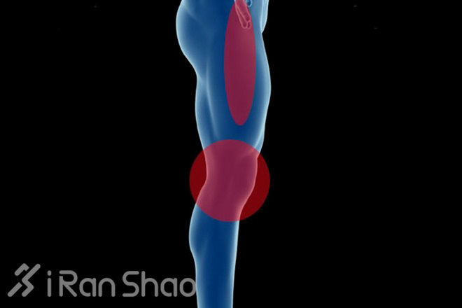 隐藏在膝盖周围的杀手—髂胫束综合征（ITBS）介绍与防治