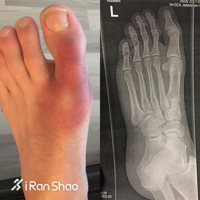 深度 | 不一样的777挑战 7大洲7场超马只为7所学校募集善款