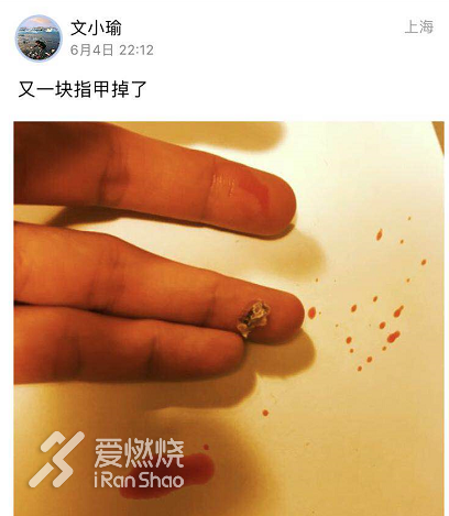 有梦就去追 想跑就去飞