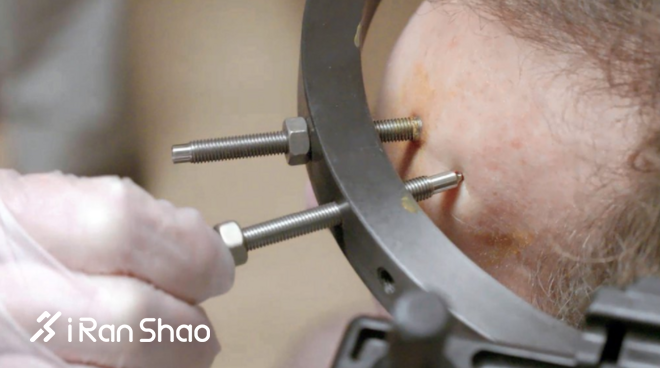 波士顿马拉松 | 戴紧箍咒的男人