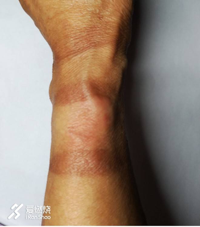 完成越野１６８  跑步愿景终成真 ——2018崇礼168公里越野赛记