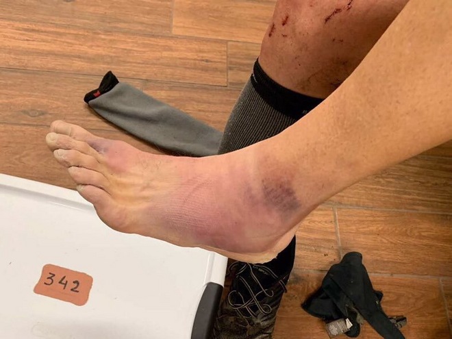 Barkley Marathons | 终点望尘莫及 而一路充满惊奇