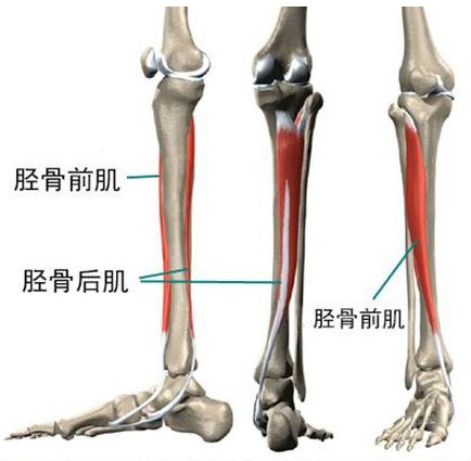 你跑步时小腿前侧疼痛吗？