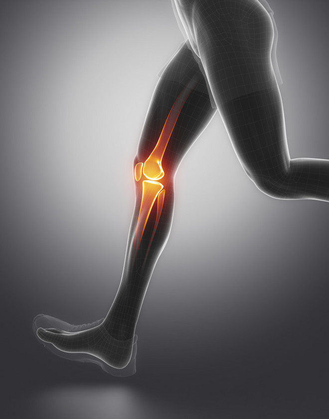 跑步膝盖疼有必要戴护膝吗？