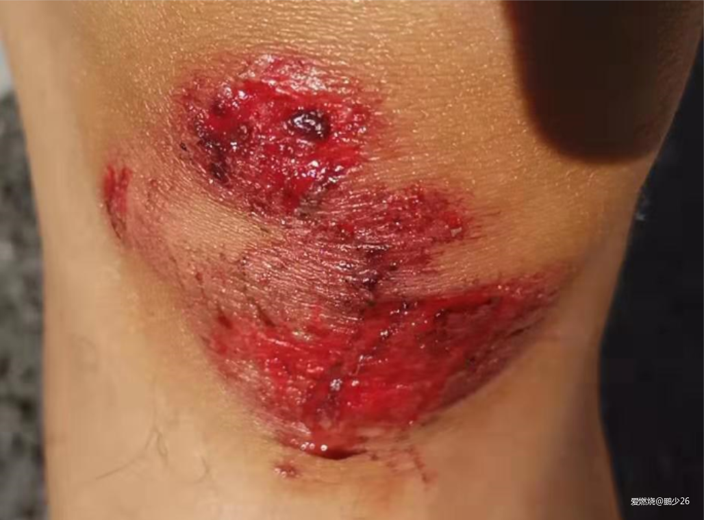 一群人的盛宴——记五岳寨50公里越野赛