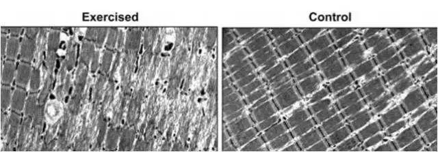 跑完马拉松为什么那么酸？怎样才能不酸？