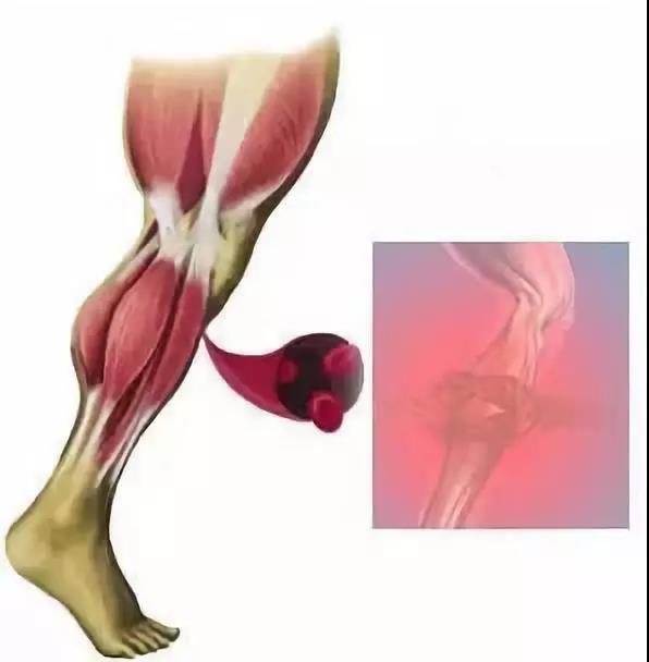 不认真训练，你还敢参加马拉松？