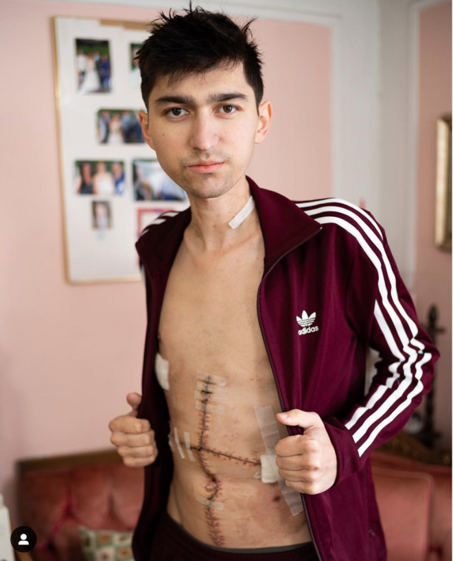 “1年前医生说我活不过3个月，现在我准备跑明年的纽约马拉松”