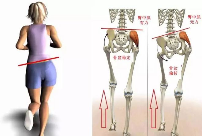 “我跑不快是因为臀部力量不够吗？”