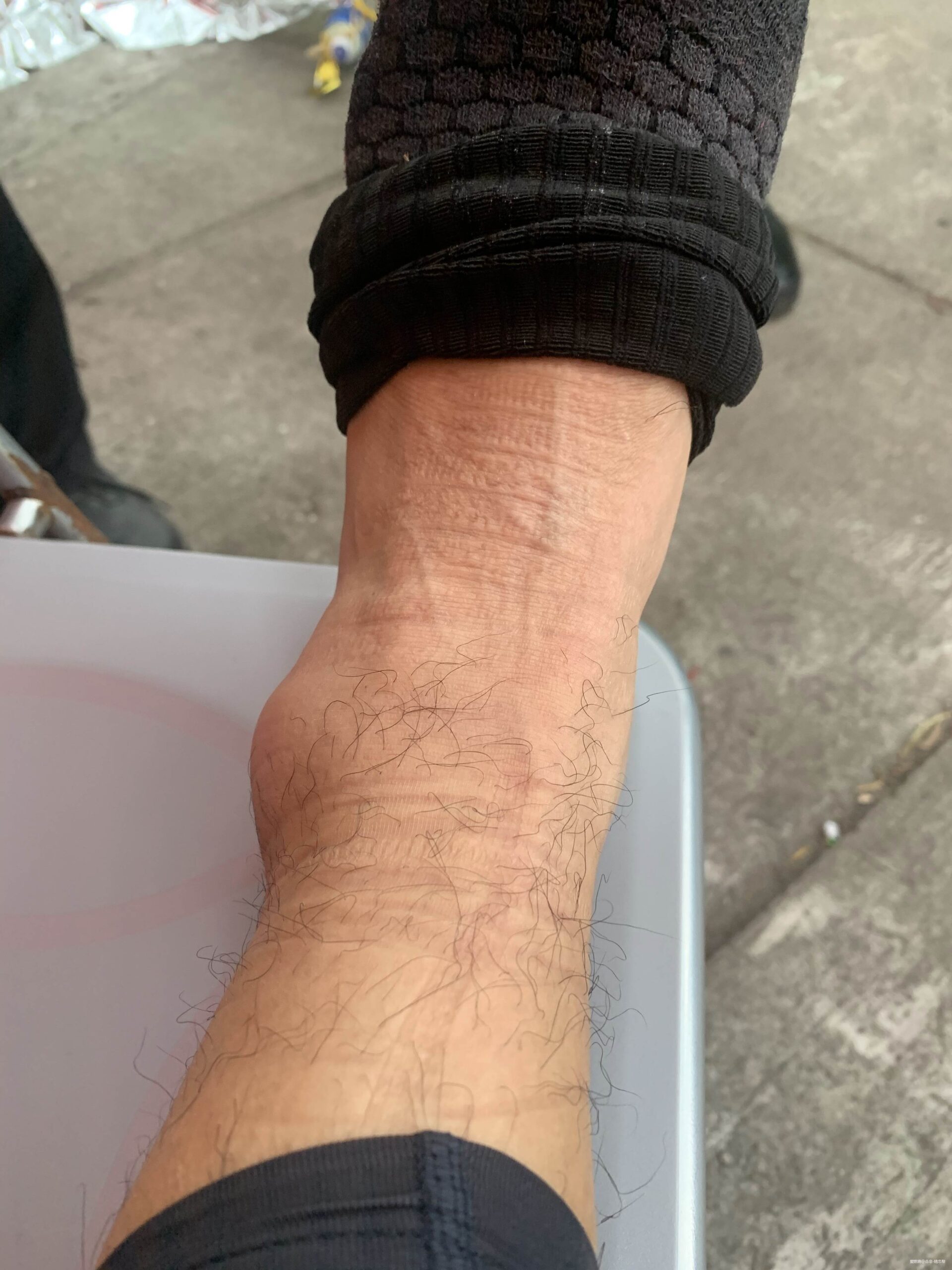 一场港百，一次残酷的战斗 |2020港百记忆