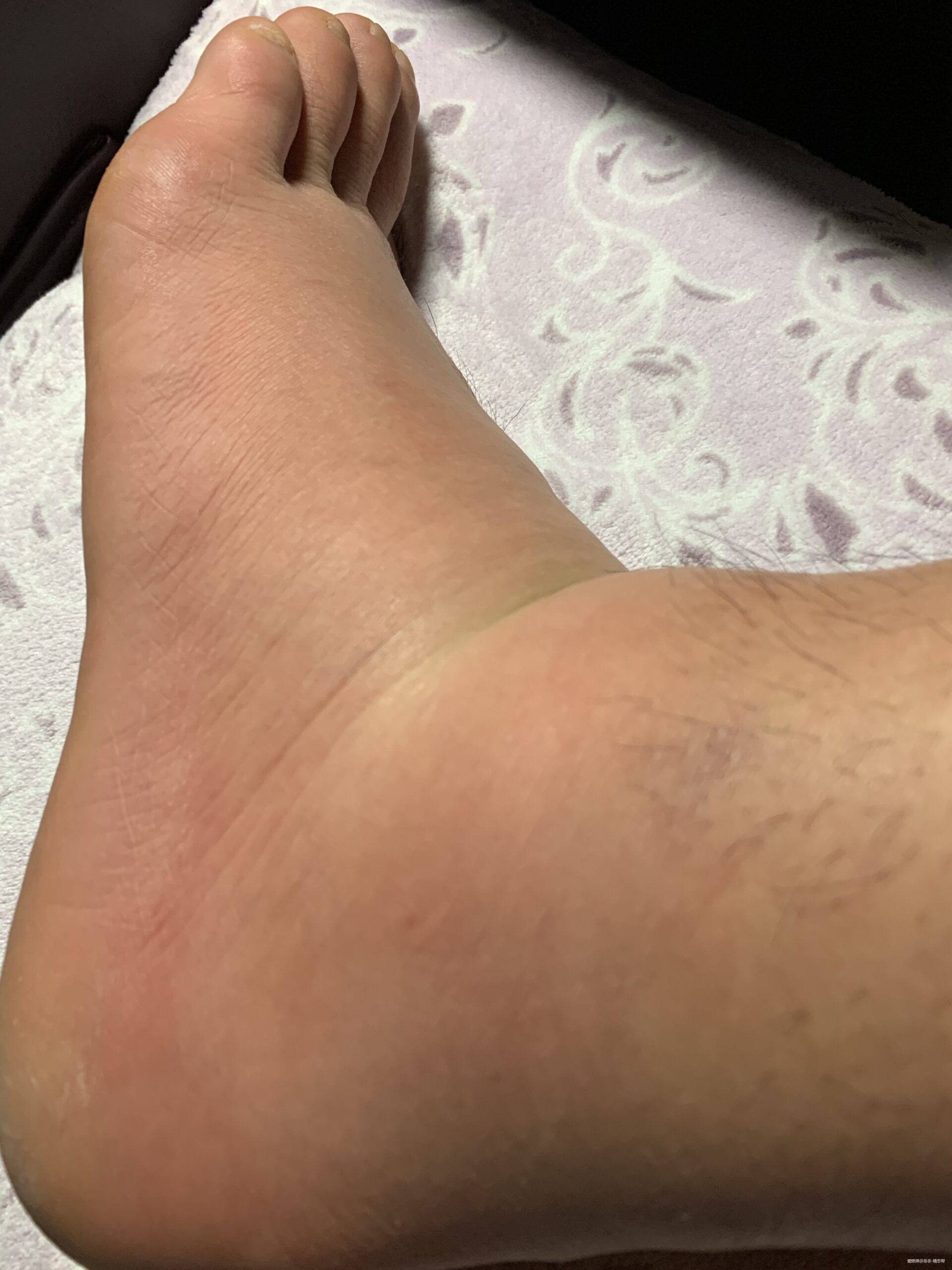 一场港百，一次残酷的战斗 |2020港百记忆