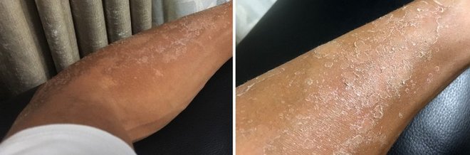 “八美胜境 . 别致雅拉”——记顶石100超级越野大师赛60KM！