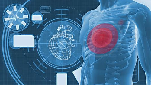 都知道“跑步膝”，但你听说过“跑步心”吗？