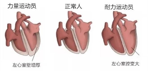 都知道“跑步膝”，但你听说过“跑步心”吗？