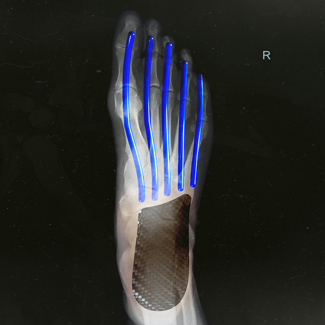 为破纪录而生！阿迪达斯推出革命性长距离跑鞋ADIZERO ADIOS PRO