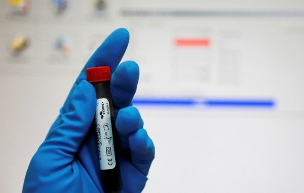 长跑之国的另一面：肯尼亚与兴奋剂